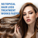 5% Minoxidil Hair Growth Spray For Men and Women 100ML