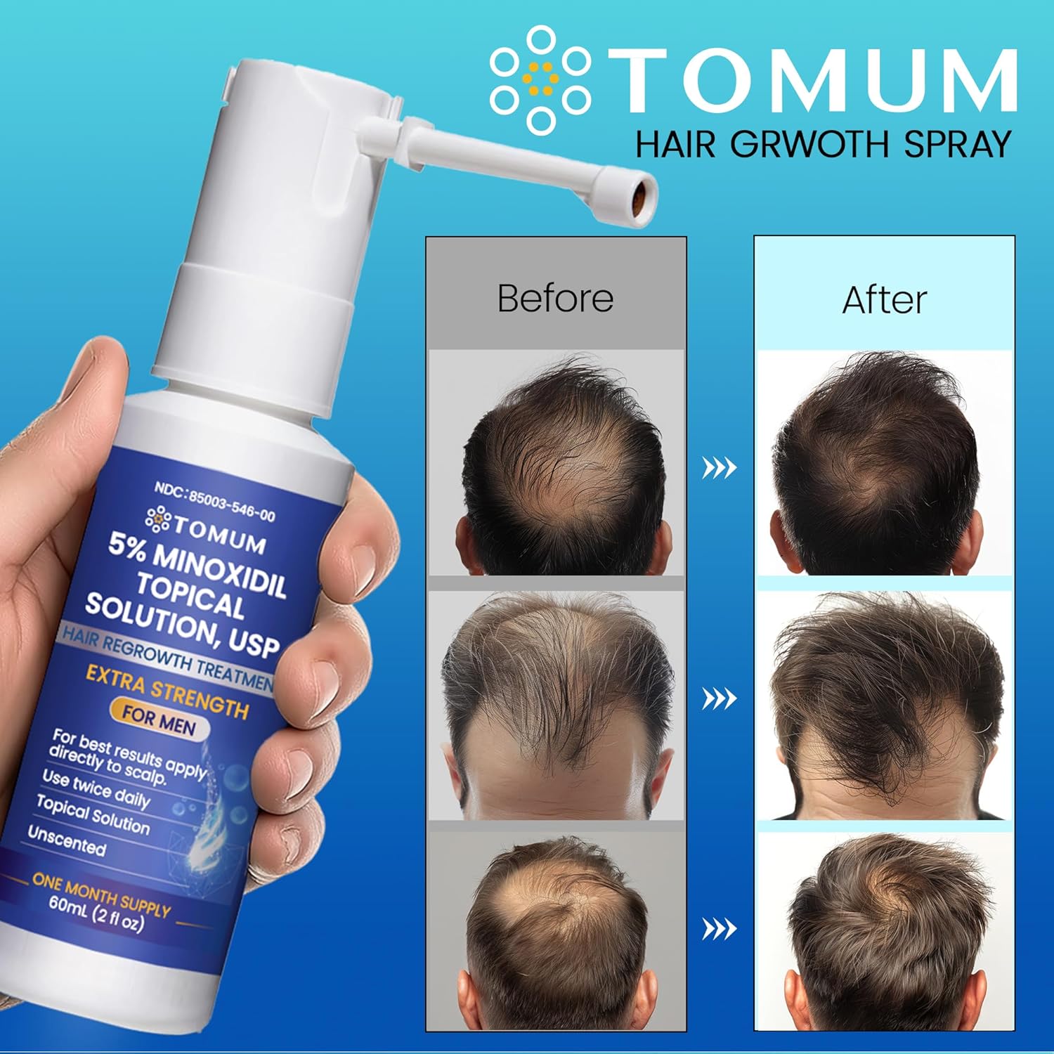 Men's 5% Minoxidil Hair Growth - Image 6